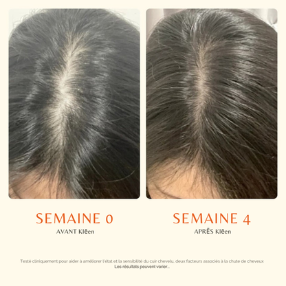 Sérum Cuir Chevelu avec Brosse