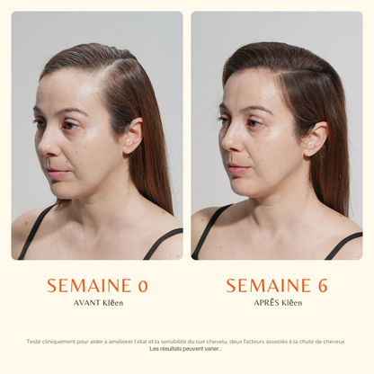 Sérum Cuir Chevelu avec Brosse